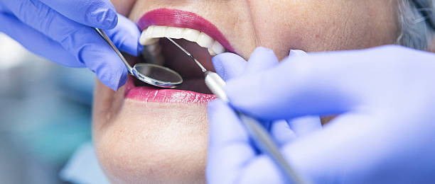 Best Emergency Wisdom Tooth Extraction in Beaumont, CA